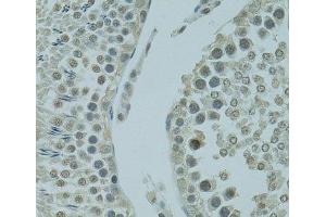 Immunohistochemistry of paraffin-embedded Rat testis using PRDM2 Polyclonal Antibody at dilution of 1:100 (40x lens). (PRDM2 Antikörper)