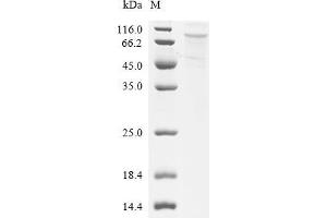 (Tris-Glycine gel) Discontinuous SDS-PAGE (reduced) with 5 % enrichment gel and 15 % separation gel.