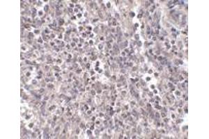 Immunohistochemistry of EBI3 in human spleen tissue with EBI3 antibody at 2. (EBI3 Antikörper  (Center))