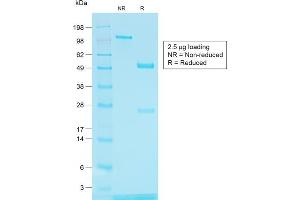 SDS-PAGE Analysis of Purified TYRP1 Rabbit Recombinant Monoclonal Antibody (TYRP1/1564R) (Tyrosinase-Related Protein 1 Antikörper)