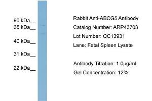 WB Suggested Anti-ABCG5 Antibody Titration:  0.
