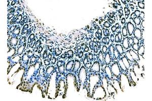 IHC analysis of KLF4 using anti-KLF4 antibody (ABIN7599343). (KLF4 Antikörper  (AA 1-389))