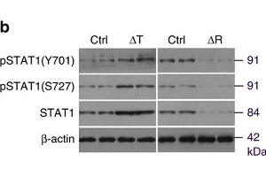 mTORC1 regulates CXCL9 in osteoblasts via STAT1. (STAT1 Antikörper  (pTyr701))