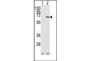 Image no. 1 for anti-Protein Inhibitor of Activated STAT, 1 (PIAS1) (C-Term) antibody (ABIN356763) (PIAS1 Antikörper  (C-Term))