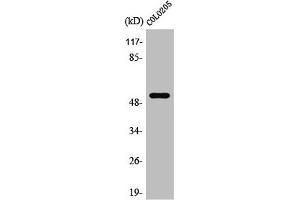 Western Blot analysis of Jurkat cells using PRP19 Polyclonal Antibody (PRP19 Antikörper  (Internal Region))