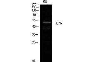 Western Blot (WB) analysis of KB cells using IL-7R Polyclonal Antibody.