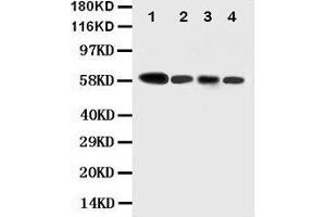 Anti-Caspase-10 antibody, Western blotting Lane 1: COLO320 Cell Lysate Lane 2: HELA Cell Lysate Lane 3: SW620 Cell Lysate Lane 4: RAJI Cell Lysate