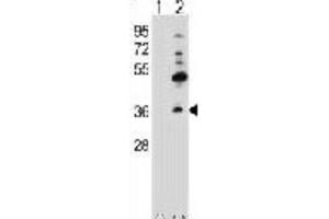 Western Blotting (WB) image for anti-Gap Junction Protein, beta 4, 30.3kDa (GJB4) antibody (ABIN2998429) (GJB4 Antikörper)