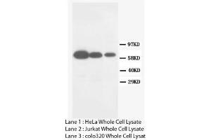 Image no. 2 for anti-Matrix Metallopeptidase 16 (Membrane-inserted) (MMP16) (C-Term) antibody (ABIN1493062) (MMP16 Antikörper  (C-Term))