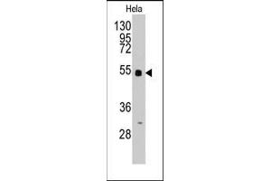 Western blot analysis of anti-BBS4 Pab in Hela cell line lysates (35ug/lane).