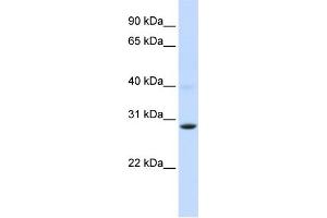 WB Suggested Anti-PGAM2 Antibody Titration:  0. (PGAM2 Antikörper  (Middle Region))