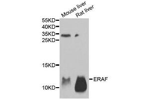 Western blot analysis of extracts of various tissues, using AHSP antibody.