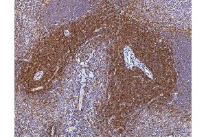 IHC analysis of Cd2 using anti-Cd2 antibody (ABIN7601386). (CD2 Antikörper  (AA 34-330))
