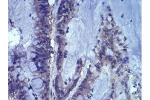 Immunohistochemistry (IHC) image for anti-Lymphoid Enhancer-Binding Factor 1 (LEF1) (AA 33-138) antibody (ABIN5542525)