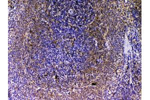 Immunohistochemistry (IHC) image for anti-Vascular Endothelial Growth Factor B (VEGFB) (AA 22-207) antibody (ABIN5692963)