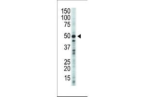 GSK3 beta Antikörper  (N-Term)