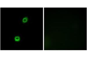 Immunofluorescence analysis of A549 cells, using MARCKS (Ab-158) Antibody. (MARCKS Antikörper  (AA 126-175))