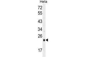UQCRFS1 Antibody (C-term) western blot analysis in Hela cell line lysates (35 µg/lane). (UQCRFS1 (Complex III Subunit Rieske) (AA 188-217), (C-Term) Antikörper)