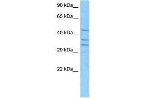 Host:  Mouse  Target Name:  RUVBL2  Sample Tissue:  Mouse Kidney  Antibody Dilution:  1ug/ml (RUVBL2 Antikörper  (N-Term))