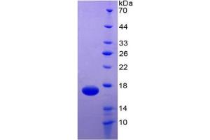 SDS-PAGE (SDS) image for TEK Tyrosine Kinase, Endothelial (TEK) ELISA Kit (ABIN6730884)