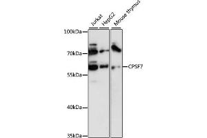 Western blot analysis of extracts of various cell lines, using CPSF7 antibody (ABIN6131022, ABIN6140675, ABIN6140676 and ABIN6218037) at 1:3000 dilution. (CPSF7 Antikörper  (AA 50-240))