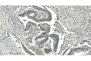 IHC analysis of LSM5 using anti-LSM5 antibody (ABIN7602503).