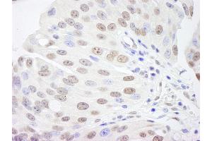 Immunohistochemistry (IHC) image for anti-Retinoblastoma Binding Protein 4 (RBBP4) (AA 1-50) antibody (ABIN7448756)