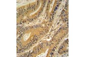 Immunohistochemistry (Paraffin-embedded Sections) (IHC (p)) image for anti-Guanine Nucleotide Binding Protein, alpha Transducing 3 (GNAT3) (AA 85-113), (Middle Region) antibody (ABIN952565)