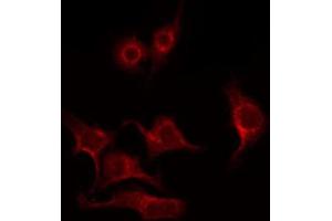 ABIN6269096 staining HeLa by IF/ICC. (PKC beta Antikörper  (C-Term))