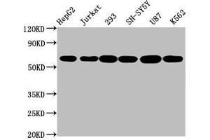 Western Blotting (WB) image for anti-Cytochrome P450, Family 19, Subfamily A, Polypeptide 1 (CYP19A1) antibody (ABIN7127445)