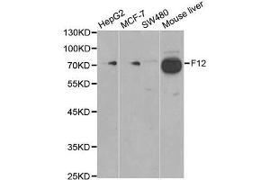 Western blot analysis of extracts of various cell lines, using F12 antibody. (F12 Antikörper)