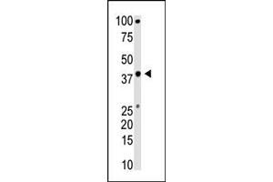 Image no. 1 for anti-BMI1 Polycomb Ring Finger Oncogene (BMI1) (C-Term) antibody (ABIN357748) (BMI1 Antikörper  (C-Term))