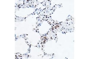 Immunohistochemistry of paraffin-embedded rat lung using YE Rabbit pAb (ABIN6130808, ABIN6150331, ABIN6150332 and ABIN6221925) at dilution of 1:100 (40x lens). (GAS41 Antikörper  (AA 1-227))