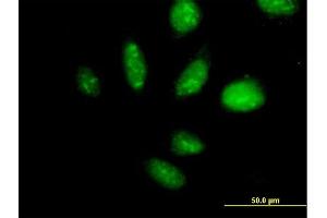 Immunofluorescence of purified MaxPab antibody to TAF1B on HeLa cell. (TAF1B Antikörper  (AA 1-588))