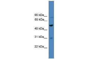 WB Suggested Anti-ZNF577 Antibody Titration:  0. (ZNF577 Antikörper  (C-Term))