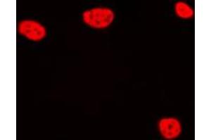 Immunofluorescent analysis of TCEB3C staining in Jurkat cells. (TCEB3C Antikörper  (C-Term))