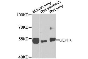 Western blot analysis of extracts of various cell lines, using GLP1R antibody (ABIN5996035) at 1/1000 dilution. (GLP1R Antikörper)