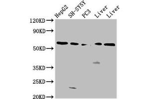 Western Blot Positive WB detected in: HepG2 whole cell lysate, SH-SY5Y whole cell lysate, PC-3 whole cell lysate, Rat liver tissue, Mouse liver tissue All lanes: UGT1A1 antibody at 4. (UGT1A1 Antikörper  (AA 395-482))