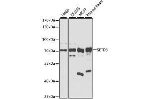 Western blot analysis of extracts of various cell lines, using SETD3 antibody.