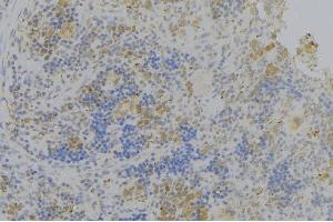 ABIN6276336 at 1/100 staining Human lymph node tissue by IHC-P.