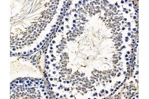 ABIN7096647 and ABIN7100712 at 1/100 staining rat testis tissue by IHC-P. (RAX Antikörper)