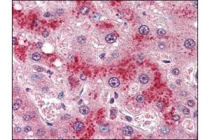 Human Liver (formalin-fixed, paraffin-embedded) stained with LEPRat 4 µg/ml followed by biotinylated anti-goat IgG secondary antibody, alkaline phosphatase-streptavidin and chromogen. (Leptin Receptor Antikörper  (Internal Region))