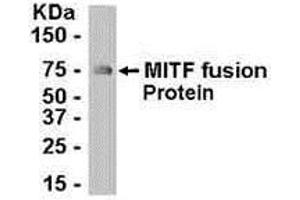 Western Blotting (WB) image for anti-Microphthalmia-Associated Transcription Factor (MITF) (AA 287-417) antibody (ABIN2467990) (MITF Antikörper  (AA 287-417))