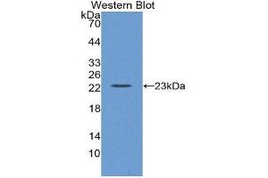 Western Blotting (WB) image for anti-Lectin, Galactoside-Binding, Soluble, 8 (LGALS8) (AA 151-316) antibody (ABIN1862521)