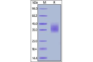 SDS-PAGE (SDS) image for SLAM Family Member 7 (SLAMF7) (AA 23-226) protein (FITC,His tag) (ABIN6731305)