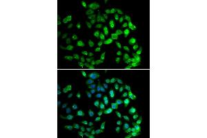 Immunofluorescence analysis of U2OS cells using GPS1 antibody. (GPS1 Antikörper)