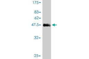 Western Blot detection against Immunogen (44. (KCNE4 Antikörper  (AA 1-170))