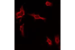 ABIN6274461 staining HepG2 by IF/ICC. (MAP4K1 Antikörper  (Internal Region))