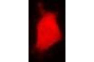 Immunofluorescent analysis of PARN staining in U2OS cells. (PARN Antikörper)
