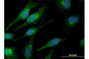Immunofluorescence of monoclonal antibody to CTNNB1 on HeLa cell. (CTNNB1 Antikörper  (AA 682-781))
